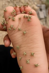 الأشواك في القدم والندوب في جسد الوطن 1 IMG 20250727 WA0085