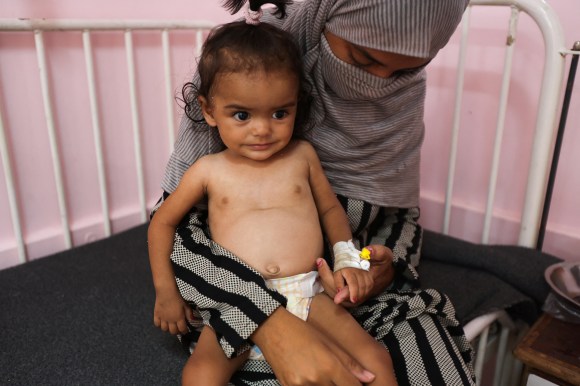 أطفال غزة على شفا المجاعة في ظل شح المكملات الغذائية 1 image c5157a 89760396